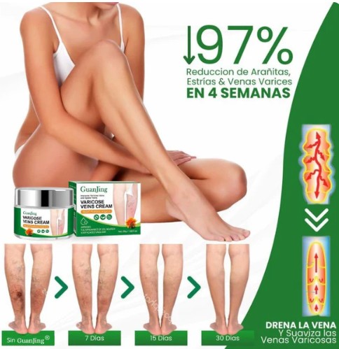 CREMA PARA LAS VARICES